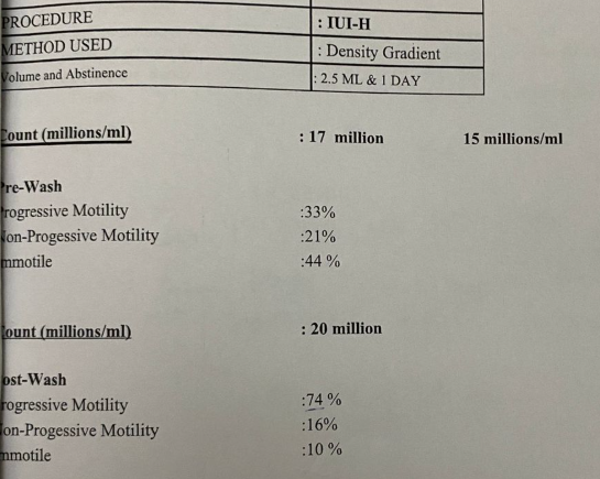 Shiva's semen analysis on the day of the IUI procedure showing 17 million count with 33% progressive motility pre-wash, and 20 million with 74% progressive motility post-wash