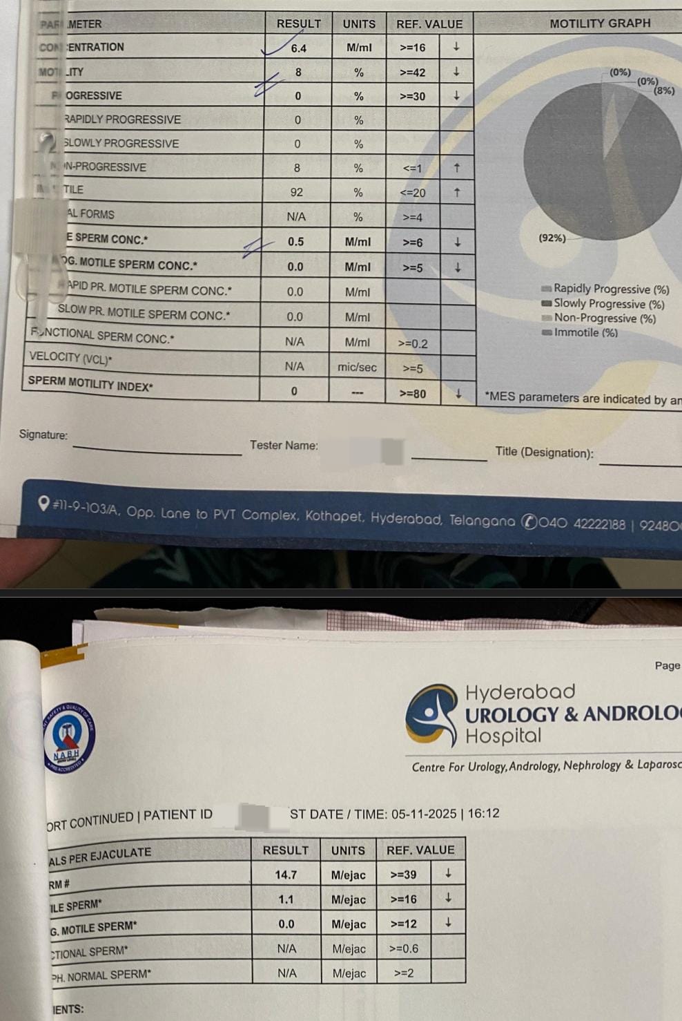 Shiva's initial semen analysis showing concentration 6.4 million/ml, total motility 8%, progressive motility 0% and 92% immotile sperm